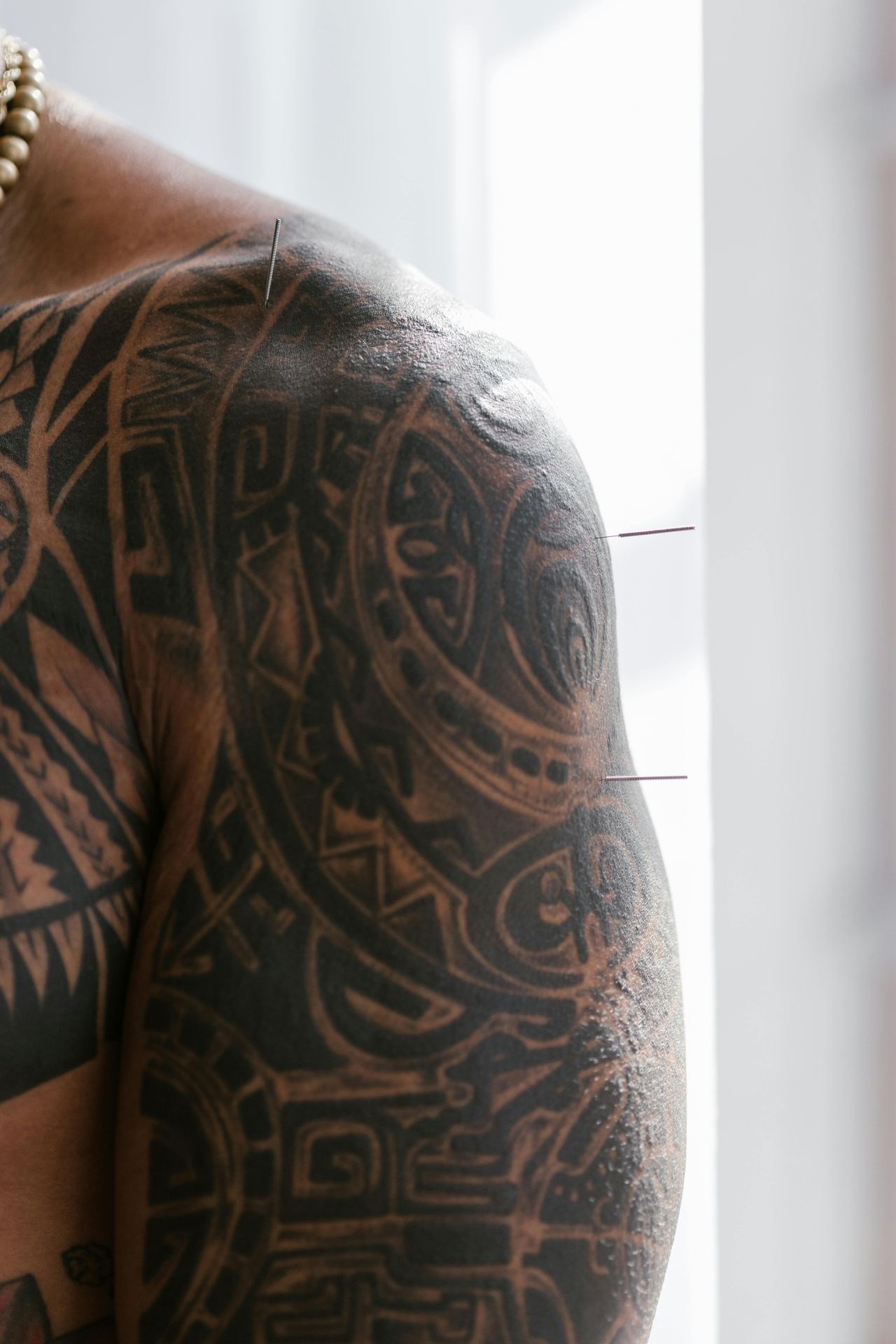 Acupuncture for shoulder pain